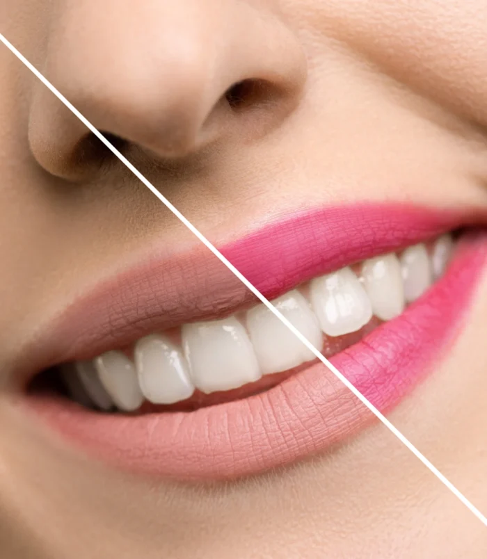 inuwet-rouge_a_levres_brillant-flower_in_a_box_pink-fraise-2